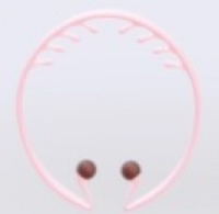 スッキリフレ こめかみ